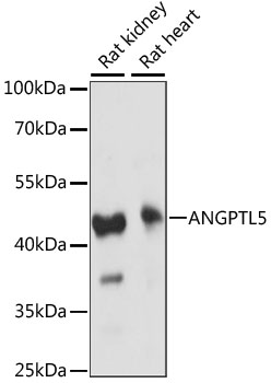 ANGPTL5 Antibody - Western blot analysis of extracts of various cell lines, using ANGPTL5 antibody at 1:1000 dilution. The secondary antibody used was an HRP Goat Anti-Rabbit IgG (H+L) at 1:10000 dilution. Lysates were loaded 25ug per lane and 3% nonfat dry milk in TBST was used for blocking. An ECL Kit was used for detection and the exposure time was 60S.