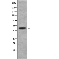 ANGPTL5 Antibody - Western blot analysis of ANGPTL5 using COLO205 whole cells lysates