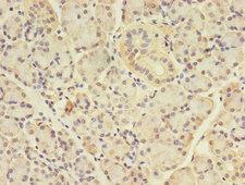 ANGPTL7 / CDT6 Antibody - Immunohistochemistry of paraffin-embedded human pancreatic tissue using ANGPTL7 Antibody at dilution of 1:100