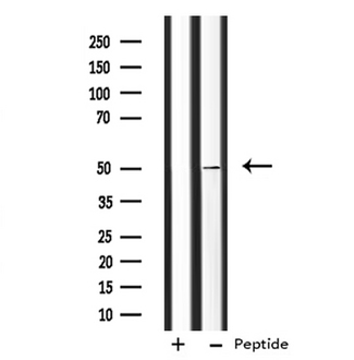 ANGPTL7 / CDT6 Antibody - Western blot analysis of extracts of HepG2 cells using ANGPTL7 antibody.