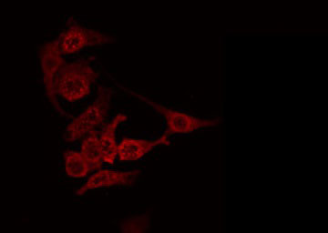 ANGPTL7 / CDT6 Antibody - Staining HeLa cells by IF/ICC. The samples were fixed with PFA and permeabilized in 0.1% Triton X-100, then blocked in 10% serum for 45 min at 25°C. The primary antibody was diluted at 1:200 and incubated with the sample for 1 hour at 37°C. An Alexa Fluor 594 conjugated goat anti-rabbit IgG (H+L) Ab, diluted at 1/600, was used as the secondary antibody.