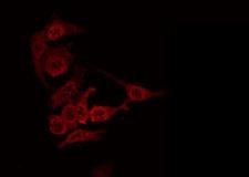 ANGPTL7 / CDT6 Antibody - Staining HeLa cells by IF/ICC. The samples were fixed with PFA and permeabilized in 0.1% Triton X-100, then blocked in 10% serum for 45 min at 25°C. The primary antibody was diluted at 1:200 and incubated with the sample for 1 hour at 37°C. An Alexa Fluor 594 conjugated goat anti-rabbit IgG (H+L) Ab, diluted at 1/600, was used as the secondary antibody.