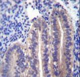 ANGPTL7 / CDT6 Antibody - ANGPTL7 Antibody immunohistochemistry of formalin-fixed and paraffin-embedded human uterus tissue followed by peroxidase-conjugated secondary antibody and DAB staining.