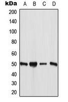 ANGPTL7 / CDT6 Antibody - Western blot analysis of ANGPTL7 expression in MCF7 (A); HUVEC (B); mouse liver (C); rat liver (D) whole cell lysates.