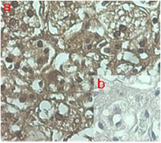 ANGPTL7 / CDT6 Antibody - Immunohistochemical staining of human tissue using anti-ANGPTL7 (human), mAb (Kairos 108-4) at 1:100 dilution. . A. Immunoperoxidase staining (cytoplasmic) of formalin-fixed, paraffin-embedded human adrenal gland (200x, brown color). . B. Isotype control with IgG1 (negative control).