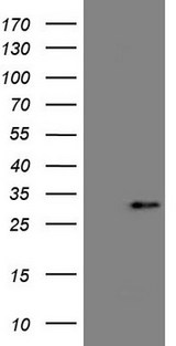 ANGPTL8 / Betatrophin Antibody - HEK293T cells were transfected with the pCMV6-ENTRY control. (Left lane) or pCMV6-ENTRY C19ORF80. (Right lane) cDNA for 48 hrs and lysed. Equivalent amounts of cell lysates. (5 ug per lane) were separated by SDS-PAGE and immunoblotted with anti-C19ORF80. (1:2000)