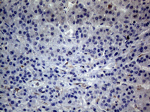 ANGPTL8 / Betatrophin Antibody - Immunohistochemical staining of paraffin-embedded Human liver tissue within the normal limits using anti-C19ORF80 mouse monoclonal antibody.This figure shows negative staining. (Heat-induced epitope retrieval by 1mM EDTA in 10mM Tris buffer. (pH8.5) at 120°C for 3 min. (1:2000)