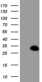 ANGPTL8 / Betatrophin Antibody - HEK293T cells were transfected with the pCMV6-ENTRY control. (Left lane) or pCMV6-ENTRY C19ORF80. (Right lane) cDNA for 48 hrs and lysed. Equivalent amounts of cell lysates. (5 ug per lane) were separated by SDS-PAGE and immunoblotted with anti-C19ORF80. (1:2000)
