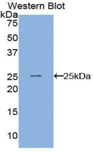 ANGPTL8 / Betatrophin Antibody - Western blot of recombinant LOC55908 / TD26.  This image was taken for the unconjugated form of this product. Other forms have not been tested.