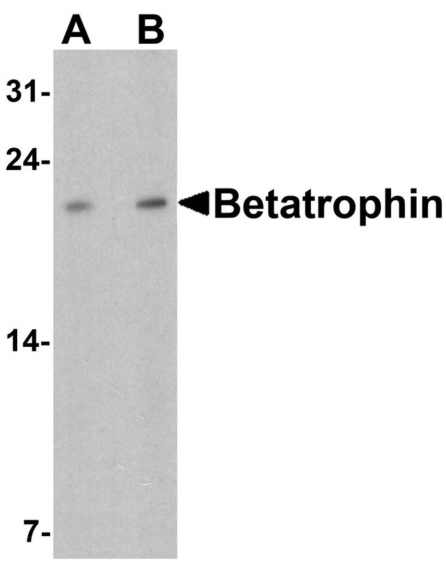 ANGPTL8 / Betatrophin Antibody - Western blot analysis of Betatrophin in rat liver tissue lysate with Betatrophin antibody at (A) 1 and (B) 2 ug/ml.