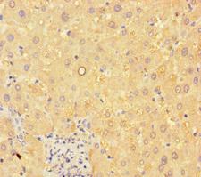 ANGPTL8 / Betatrophin Antibody - Immunohistochemistry of paraffin-embedded human liver tissue using ANGPTL8 Antibody at dilution of 1:100