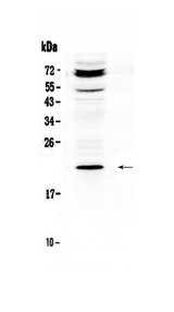ANGPTL8 / Betatrophin Antibody - Western blot analysis of C19orf80 using anti-C19orf80 antibody. Electrophoresis was performed on a 5-20% SDS-PAGE gel at 70V (Stacking gel) / 90V (Resolving gel) for 2-3 hours. The sample well of each lane was loaded with 50ug of sample under reducing conditions. Lane 1: human HepG2 whole Cell lysate. After Electrophoresis, proteins were transferred to a Nitrocellulose membrane at 150mA for 50-90 minutes. Blocked the membrane with 5% Non-fat Milk/ TBS for 1.5 hour at RT. The membrane was incubated with rabbit anti-C19orf80 antigen affinity purified polyclonal antibody at 0.5 µg/mL overnight at 4°C, then washed with TBS-0.1% Tween 3 times with 5 minutes each and probed with a goat anti-rabbit IgG-HRP secondary antibody at a dilution of 1:10000 for 1.5 hour at RT. The signal is developed using an Enhanced Chemiluminescent detection (ECL) kit with Tanon 5200 system. A specific band was detected for C19orf80 at approximately 22KD. The expected band size for C19orf80 is at 22KD.
