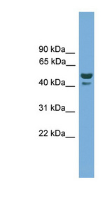 ANHX Antibody - LOC647589 antibody Western blot of Fetal Heart lysate. This image was taken for the unconjugated form of this product. Other forms have not been tested.