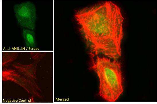 Anillin Antibody - Anillin antibody immunofluorescence analysis of paraformaldehyde fixed U2OS cells, permeabilized with 0.15% Triton. Primary incubation 1hr (10ug/ml) followed by Alexa Fluor 488 secondary antibody (2ug/ml), showing nuclear staining. Actin filaments were stained with phalloidin (red) and The nuclear stain is DAPI (blue). Negative control: Unimmunized goat IgG (10ug/ml) followed by Alexa Fluor 488 secondary antibody (2ug/ml).