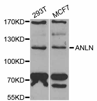 Anillin Antibody - Western blot analysis of extracts of various cell lines.