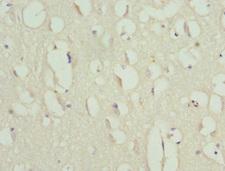 Anillin Antibody - Immunohistochemistry of paraffin-embedded human brain tissue at dilution 1:100