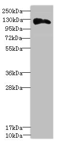 Anillin Antibody - Western blot All Lanes: ANLNantibody at 3.43ug/ml+ Hela whole cell lysate Goat polyclonal to rabbit at 1/10000 dilution Predicted band size: 125,121 kDa Observed band size: 124 kDa