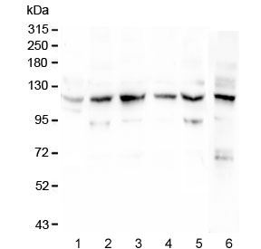 Anillin Antibody - Western blot testing of human 1) placenta, 2) SW620, 3) A431, 4) HL60, 5) PC-3 and 6) mouse NIH 3T3 lysate with Anillin antibody at 0.5ug/ml. Predicted molecular weight ~124 kDa.