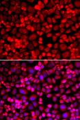 Anillin Antibody - Immunofluorescence analysis of A549 cells using ANLN Polyclonal Antibody.