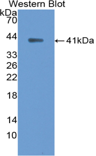 ANK1 / Ankyrin Antibody - Western blot of ANK1 / Ankyrin antibody.