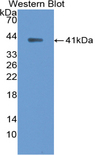 ANK1 / Ankyrin Antibody - Western blot of ANK1 / Ankyrin antibody.