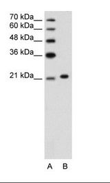 ANK1 / Ankyrin Antibody - A: Marker, B: Jurkat Cell Lysate.  This image was taken for the unconjugated form of this product. Other forms have not been tested.