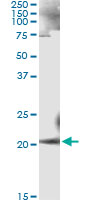 ANK1 / Ankyrin Antibody - Immunoprecipitation of ANK1 transfected lysate using anti-ANK1 monoclonal antibody and Protein A Magnetic Bead, and immunoblotted with ANK1 rabbit polyclonal antibody.