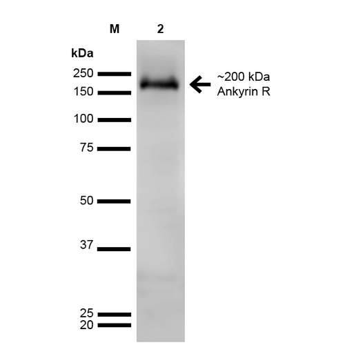 ANK1 / Ankyrin Antibody - Western Blot analysis of Rat Brain showing detection of ~200 kDa Ankyrin-R protein using Mouse Anti-Ankyrin-R Monoclonal Antibody, Clone S388A-10. Lane 1: MW Ladder. Lane 2: Rat Brain. Load: 20 µg. Block: 2% GE Healthcare Blocker for 1 hour at RT. Primary Antibody: Mouse Anti-Ankyrin-R Monoclonal Antibody  at 1:1000 for 16 hours at 4°C. Secondary Antibody: Goat Anti-Mouse IgG: HRP at 1:200 for 1 hour at RT. Color Development: ECL solution for 6 min at RT. Predicted/Observed Size: ~200 kDa.