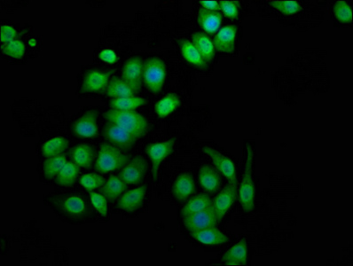 ANK3 / ANKYRIN-G Antibody - Immunofluorescence staining of PC3 cells at a dilution of 1:100, counter-stained with DAPI. The cells were fixed in 4% formaldehyde, permeabilized using 0.2% Triton X-100 and blocked in 10% normal Goat Serum. The cells were then incubated with the antibody overnight at 4 °C.The secondary antibody was Alexa Fluor 488-congugated AffiniPure Goat Anti-Rabbit IgG (H+L) .
