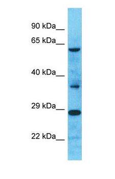 ANKDD1A Antibody - Western blot of ANKDD1A Antibody with human Fetal Liver lysate.  This image was taken for the unconjugated form of this product. Other forms have not been tested.
