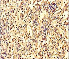ANKDD1A Antibody - Immunohistochemistry of paraffin-embedded human spleen tissue using ANKDD1A Antibody at dilution of 1:100