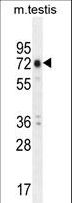 ANKEF1 / ANKRD5 Antibody - ANKRD5 Antibody western blot of mouse testis tissue lysates (35 ug/lane). The ANKRD5 antibody detected the ANKRD5 protein (arrow).