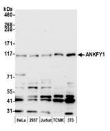 ANKFY1 Antibody - Detection of human and mouse ANKFY1 by western blot. Samples: Whole cell lysate (15 µg) from HeLa, HEK293T, Jurkat, mouse TCMK-1, and mouse NIH 3T3 cells prepared using NETN lysis buffer. Antibody: Affinity purified rabbit anti-ANKFY1 antibody used for WB at 0.1 µg/ml. Detection: Chemiluminescence with an exposure time of 30 seconds.