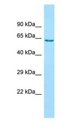 ANKFY1 Antibody - ANKFY1 antibody Western Blot of 721_B.  This image was taken for the unconjugated form of this product. Other forms have not been tested.
