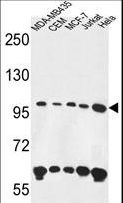 ANKFY1 Antibody - ANKFY1 Antibody western blot of MDA-MB435,CEM,MCF-7,Jurkat,HeLa cell line lysates (35 ug/lane). The ANKFY1 antibody detected the ANKFY1 protein (arrow).