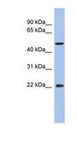 ANKH Antibody - ANKH antibody Western blot of THP-1 cell lysate. This image was taken for the unconjugated form of this product. Other forms have not been tested.