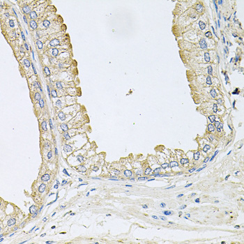 ANKH Antibody - Immunohistochemistry of paraffin-embedded human prostate.