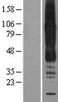 ANKH Protein - Western validation with an anti-DDK antibody * L: Control HEK293 lysate R: Over-expression lysate