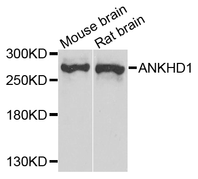 ANKHD1 Antibody - Western blot analysis of extract of various cells.