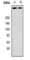 ANKHD1 Antibody - Western blot analysis of ANKHD1 expression in mouse brain (A); rat brain (B) whole cell lysates.