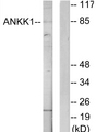 ANKK1 Antibody - Western blot analysis of lysates from HeLa cells, using ANKK1 Antibody. The lane on the right is blocked with the synthesized peptide.