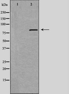 ANKK1 Antibody - Western blot analysis of extracts of HeLa cells using ANKK1 antibody. The lane on the left is treated with the antigen-specific peptide.