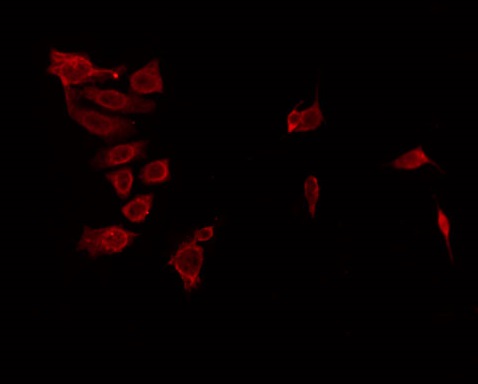 ANKK1 Antibody - Staining HeLa cells by IF/ICC. The samples were fixed with PFA and permeabilized in 0.1% Triton X-100, then blocked in 10% serum for 45 min at 25°C. The primary antibody was diluted at 1:200 and incubated with the sample for 1 hour at 37°C. An Alexa Fluor 594 conjugated goat anti-rabbit IgG (H+L) Ab, diluted at 1/600, was used as the secondary antibody.