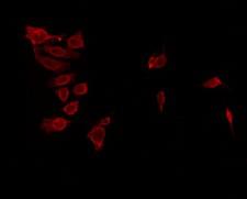 ANKK1 Antibody - Staining HeLa cells by IF/ICC. The samples were fixed with PFA and permeabilized in 0.1% Triton X-100, then blocked in 10% serum for 45 min at 25°C. The primary antibody was diluted at 1:200 and incubated with the sample for 1 hour at 37°C. An Alexa Fluor 594 conjugated goat anti-rabbit IgG (H+L) Ab, diluted at 1/600, was used as the secondary antibody.