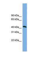 ANKMY2 Antibody - ANKMY2 antibody Western blot of RPMI-8226 cell lysate. This image was taken for the unconjugated form of this product. Other forms have not been tested.