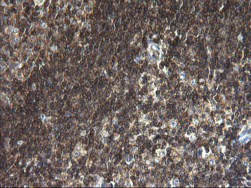 ANKMY2 Antibody - IHC of paraffin-embedded Human lymph node tissue using anti-ANKMY2 mouse monoclonal antibody. (Heat-induced epitope retrieval by 1 mM EDTA in 10mM Tris, pH8.5, 120°C for 3min).