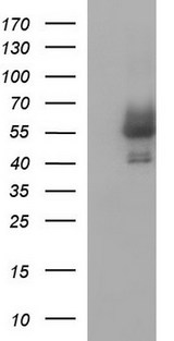 ANKMY2 Antibody - HEK293T cells were transfected with the pCMV6-ENTRY control (Left lane) or pCMV6-ENTRY ANKMY2 (Right lane) cDNA for 48 hrs and lysed. Equivalent amounts of cell lysates (5 ug per lane) were separated by SDS-PAGE and immunoblotted with anti-ANKMY2.
