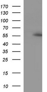 ANKMY2 Antibody - HEK293T cells were transfected with the pCMV6-ENTRY control (Left lane) or pCMV6-ENTRY ANKMY2 (Right lane) cDNA for 48 hrs and lysed. Equivalent amounts of cell lysates (5 ug per lane) were separated by SDS-PAGE and immunoblotted with anti-ANKMY2.