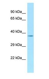 ANKRA2 / ANKRA Antibody - ANKRA2 / ANKRA antibody Western Blot of Mouse Testis.  This image was taken for the unconjugated form of this product. Other forms have not been tested.