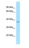 ANKRA2 / ANKRA Antibody - ANKRA2 / ANKRA antibody Western Blot of Mouse Testis.  This image was taken for the unconjugated form of this product. Other forms have not been tested.